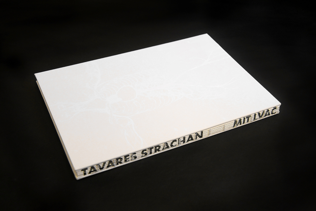 Orthostatic Tolerance: It Might Not Be Such a Bad Idea if I Never Went Home